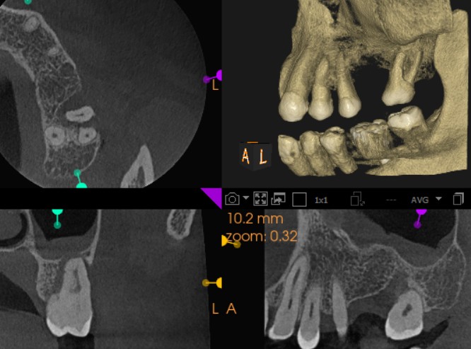 Praveen kumara_perio-endo